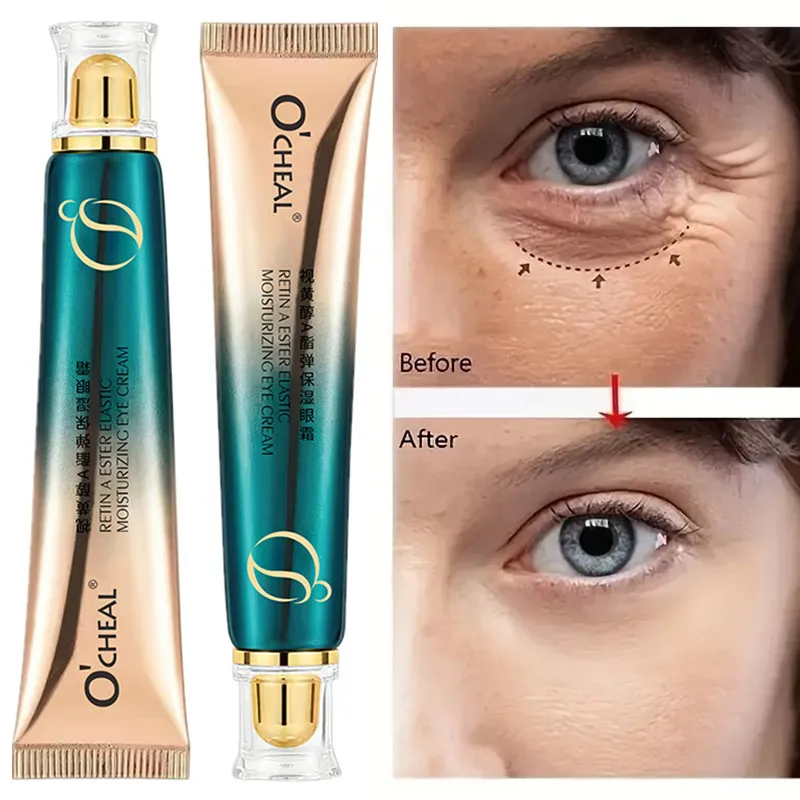 Retinol Anti Wrinkle Cream - الريتينول تتلاشى الخطوط الدقيقة المضادة للهالات
