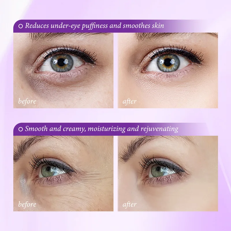 كريم فوري لإزالة انتفاخات العي - مراجعة Retinol Anti Wrinkle Cream وسعره
