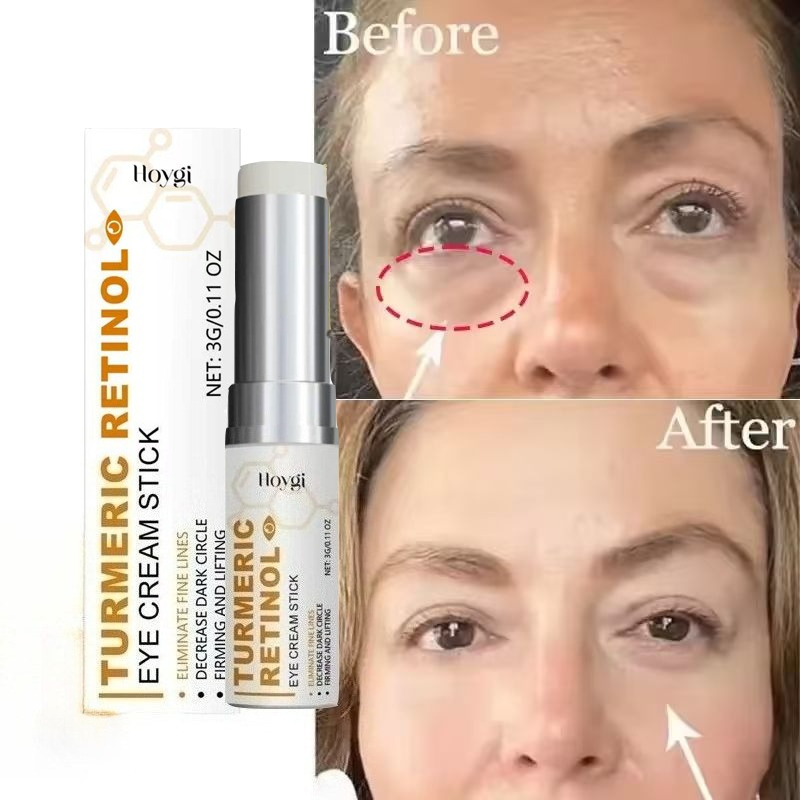 كريم فوري لإزالة انتفاخات العي - مراجعة Retinol Anti Wrinkle Cream وسعره