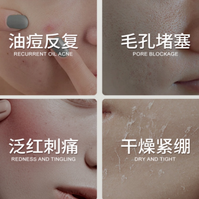 كينتيللا اسياتيكا حمض الساليسي - مراجعة Salicylic Acid Blackhead Remover وسعره